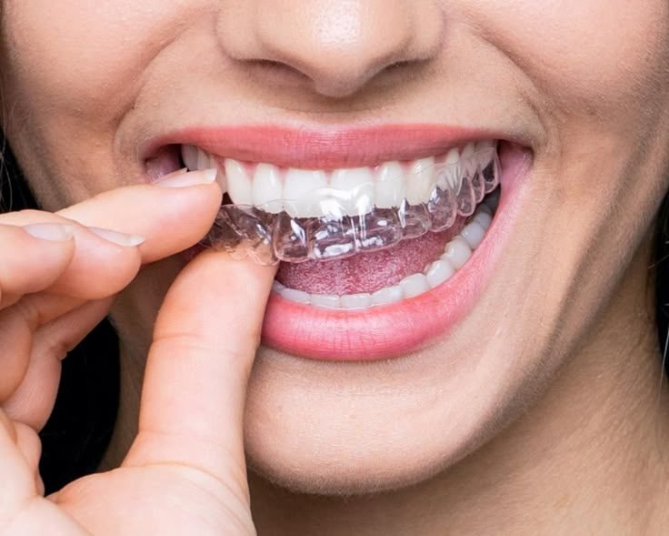 Periodontics