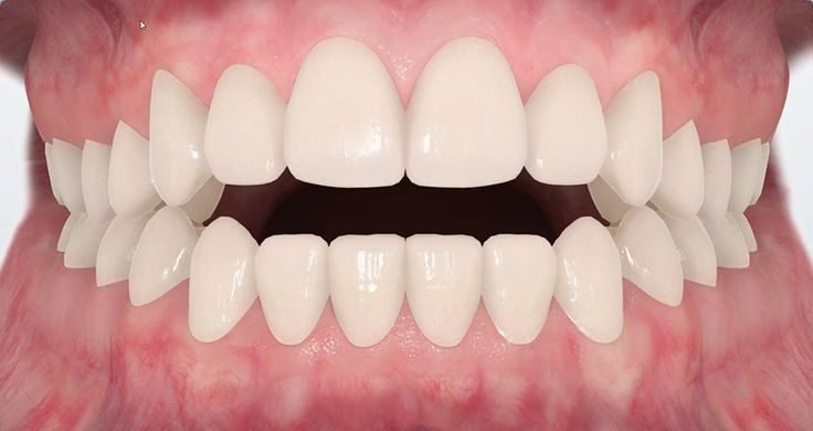 Restorative and Endodontics